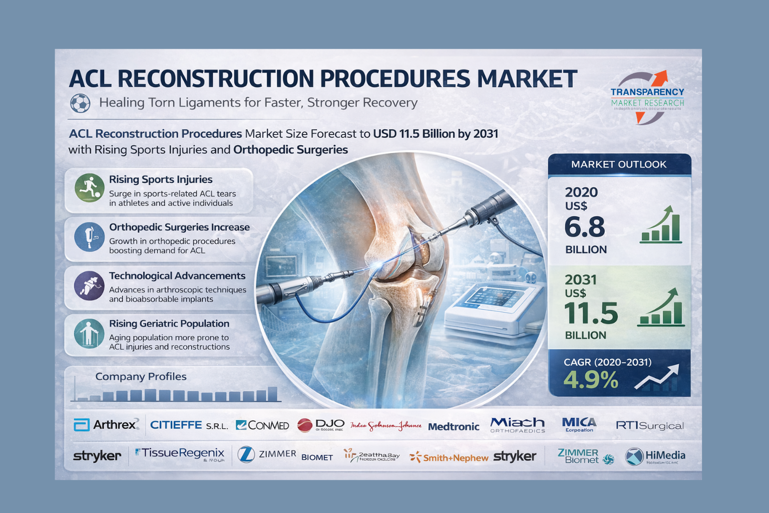 ACL Reconstruction Procedures Market Size Forecast to USD 11.5 Billion by 2031 with Rising Sports Injuries and Orthopedic Surgeries – Analysis by Transparency Market Research