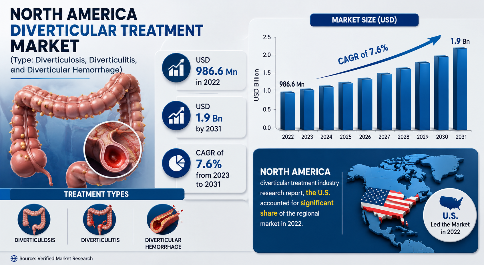 North America Diverticular Treatment Market
